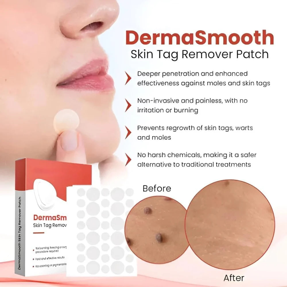 Derma Smooth Skin Tag Removal Patches - 144 Patches