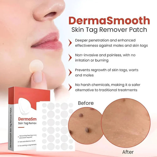 Derma Smooth Skin Tag Removal Patches - 144 Patches
