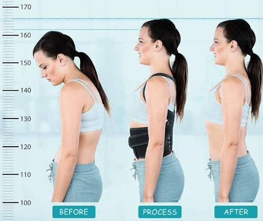 Dreamstore Posture Corrector Belt, Size: Free Size